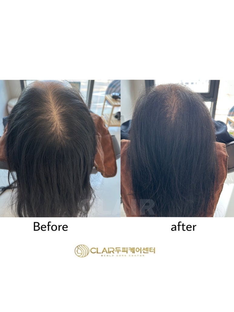 클레르두피케어센터 이미지