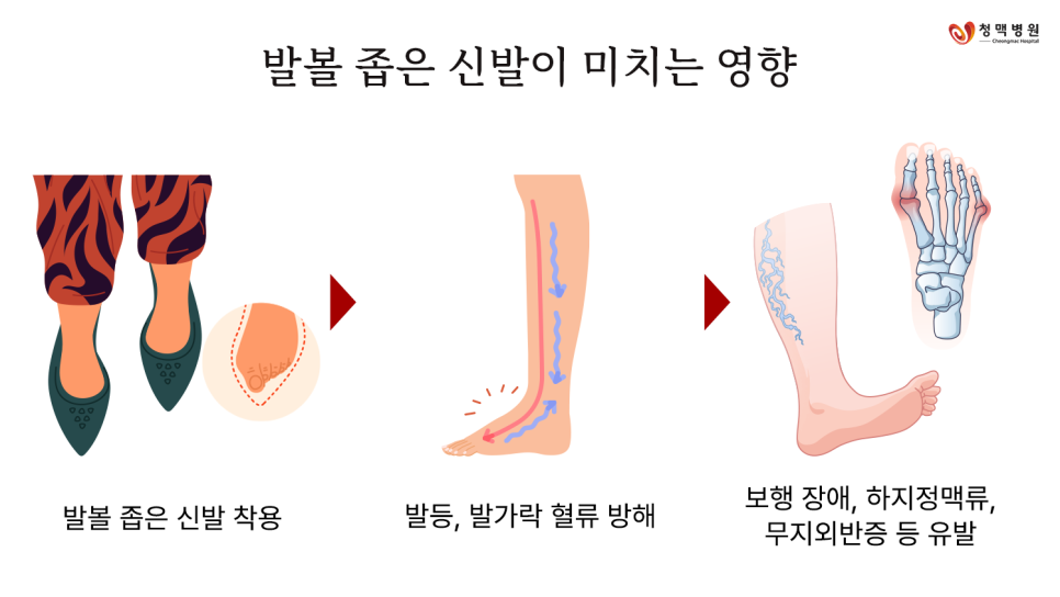 발편한신발 이미지