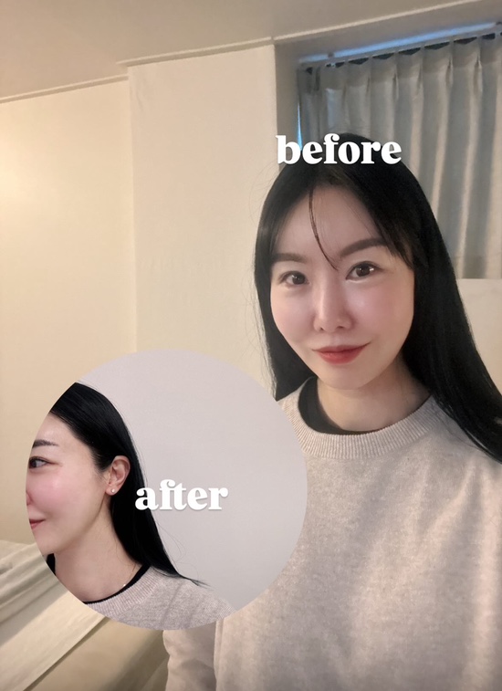 엔키뷰티 이미지