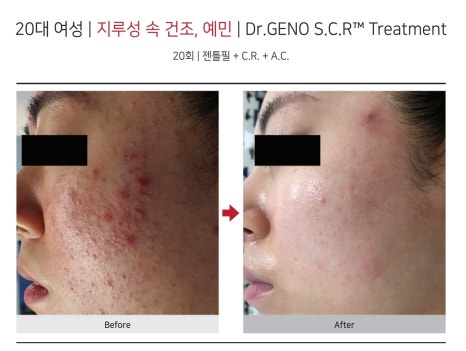수뷰티&귀족다이어트 이미지
