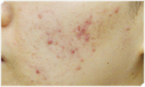 질경이수원 이미지