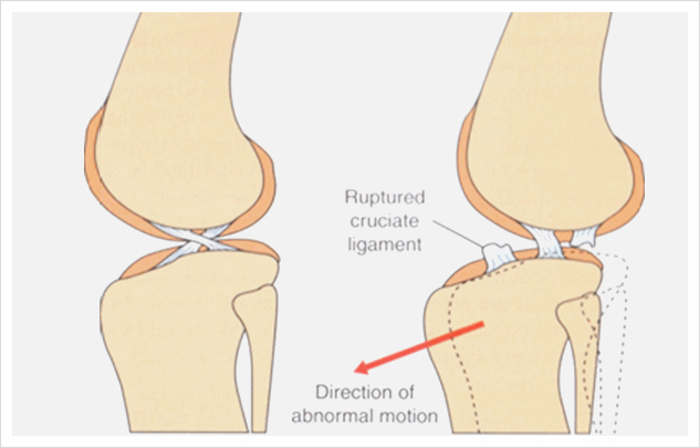 스피츠 전십자인대 단열 TPLO 수술 비용 및 회복 과정 — 사진 3