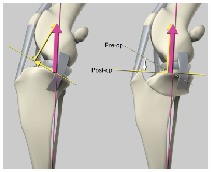스피츠 전십자인대 단열 TPLO 수술 비용 및 회복 과정 — 사진 5