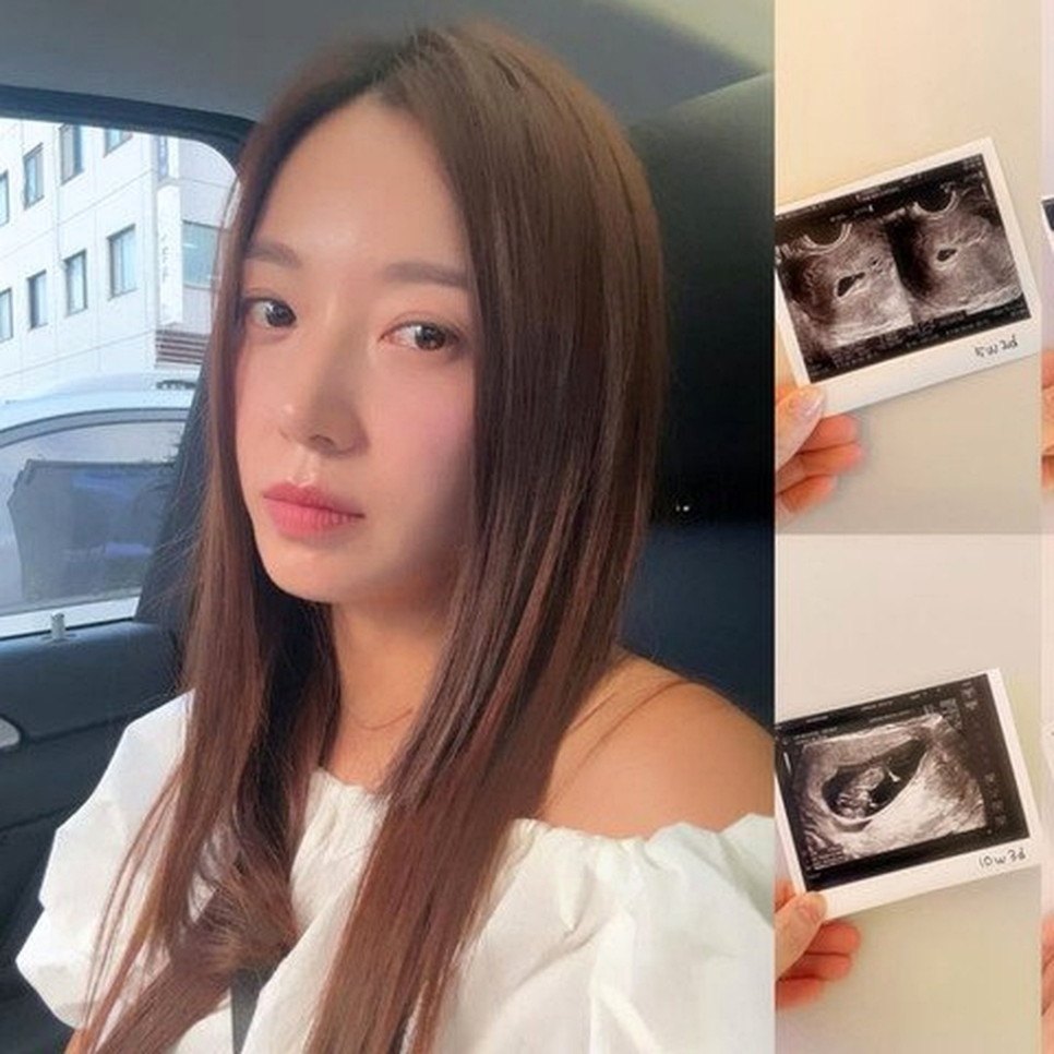 김민경, 임신 성공 46세, 말이 나오는 이유 이미지 5