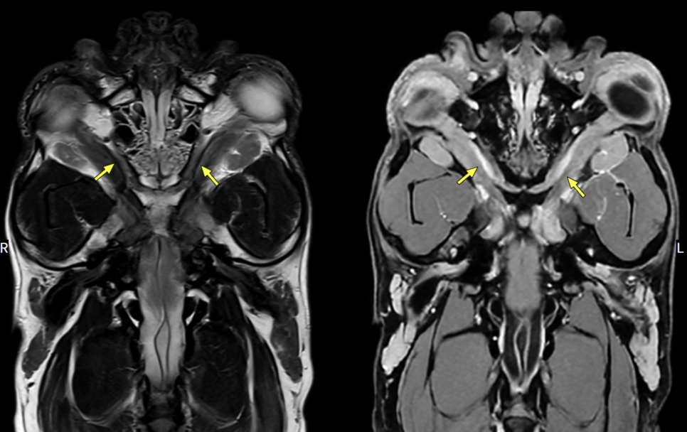 송파 강아지 두개골 종양 수술, CT·MRI 진단 및 재건 후기 — 사진 11