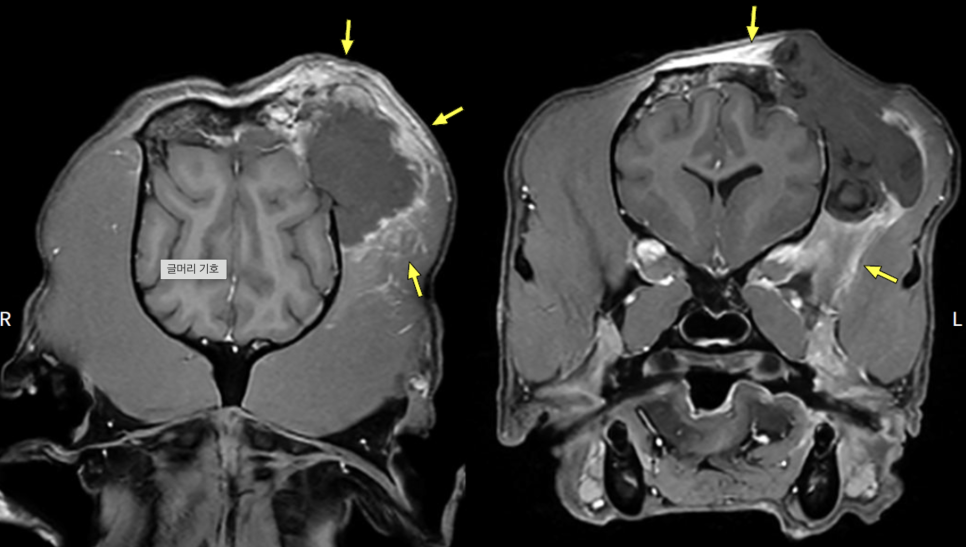 송파 강아지 두개골 종양 수술, CT·MRI 진단 및 재건 후기 — 사진 8