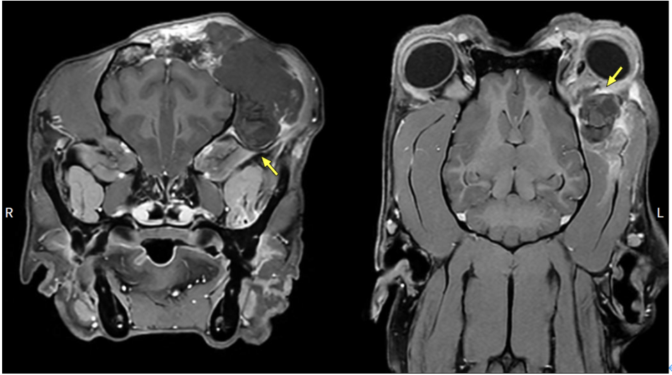 송파 강아지 두개골 종양 수술, CT·MRI 진단 및 재건 후기 — 사진 10