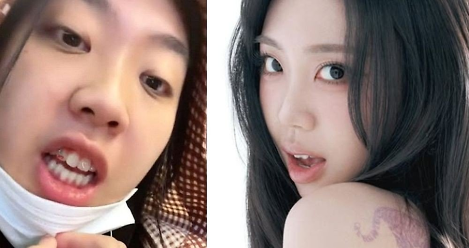 이영지 눈밑지 후 달라진 미모 요즘 들어 반응이 커지고 있다 이미지 4