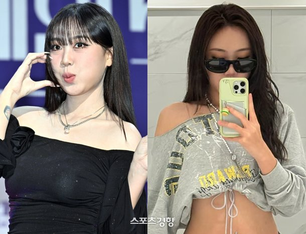 이영지 눈밑지 후 달라진 미모 요즘 들어 반응이 커지고 있다 이미지 6