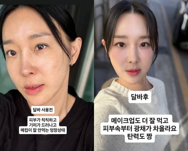 이지혜 월요병이 웬말이야. 맞아 안 맞아 한마디로 상황이 바뀌었다 이미지 2