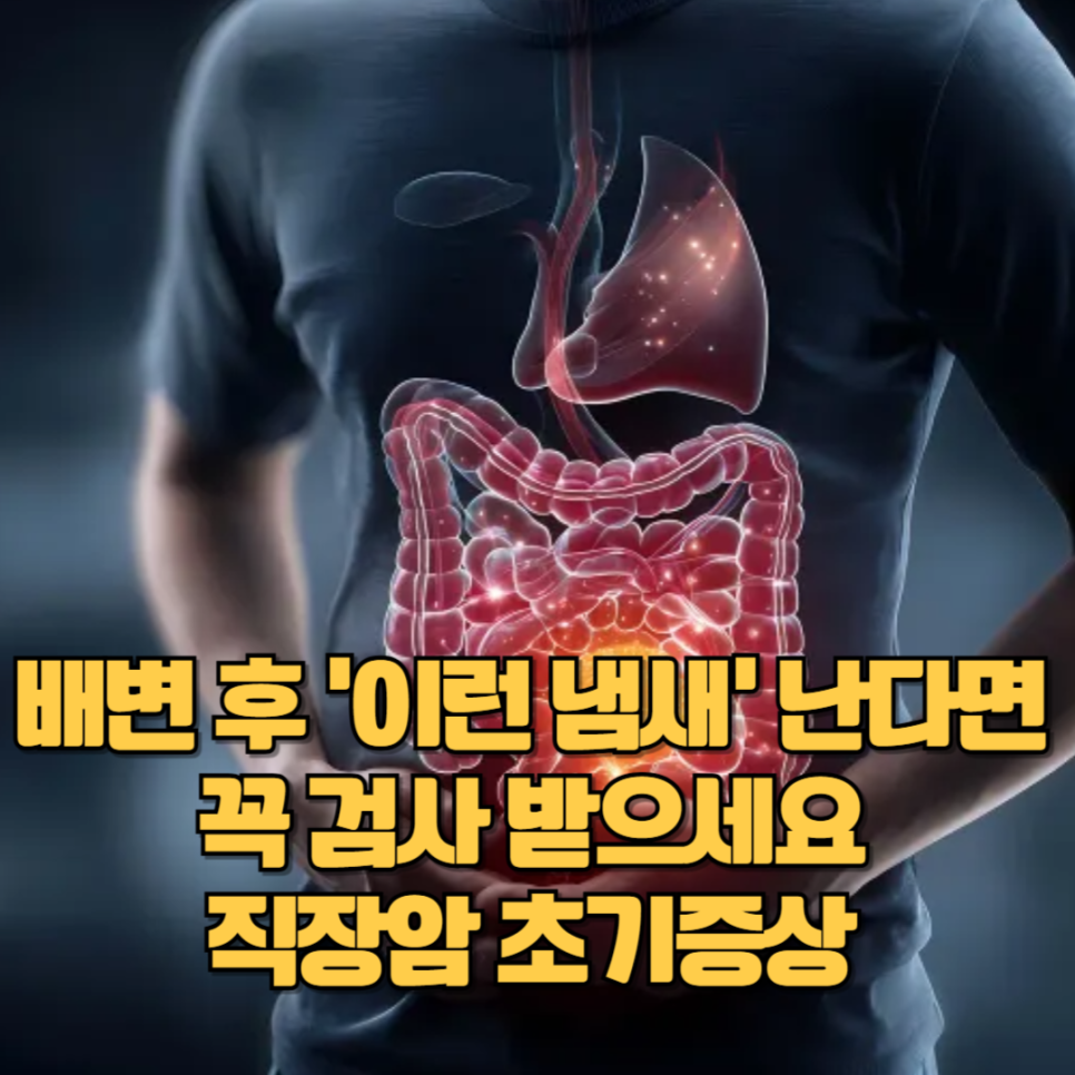 배변 후 '이런 냄새' 난다면 꼭 검사 받으세요, 직장암 초기증상 : 네이버 블로그