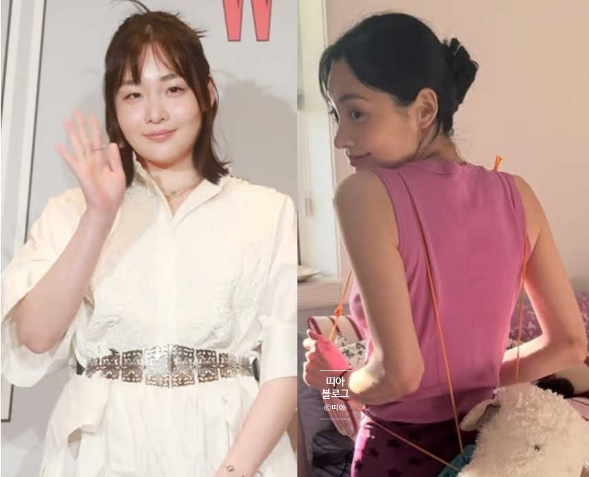 김민하까지 뼈말라 합류 앙상한 팔에 위고비 의혹까지 나온 이유 왜 이 말에 시선이 쏠렸을까 이미지 3
