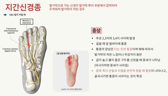 익산바른몸한의원 블로그 본문 이미지