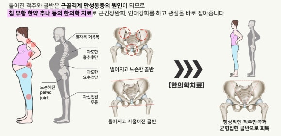 익산바른몸한의원 블로그 본문 이미지