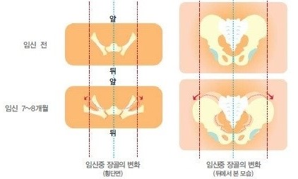 익산바른몸한의원 블로그 본문 이미지