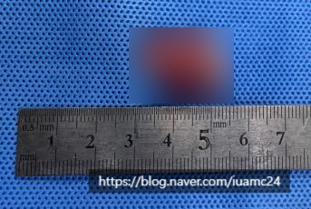 강아지 유선종양 수술, 의정부 아이유동물병원 비용 및 후기 — 사진 4