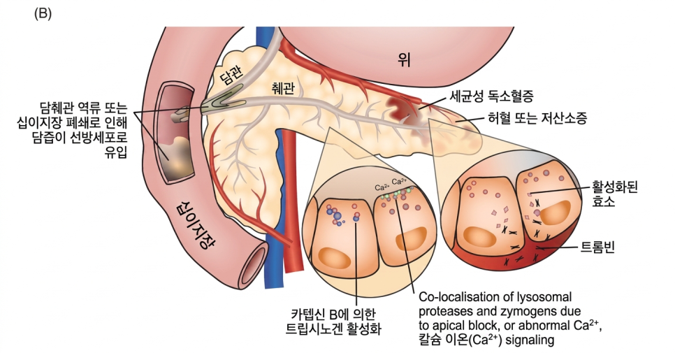 고양이 이물질 제거, 췌장염 오인 후기 — 사진 3