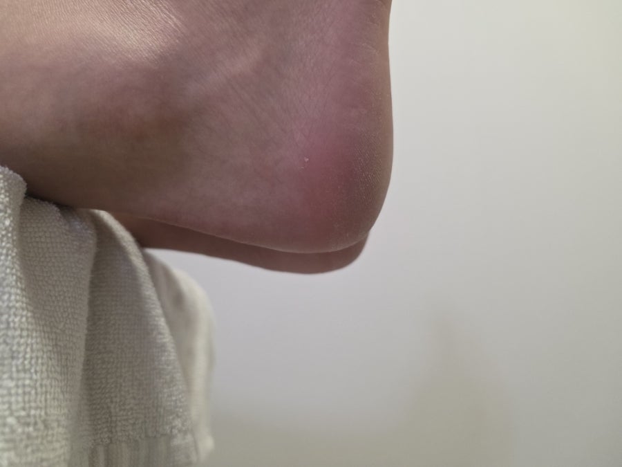 부평 발각질 제거, 아로마 풋스파로 여름 발 관리 — 사진 4