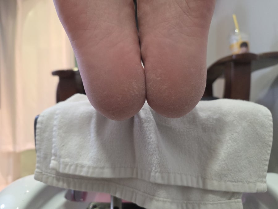 부평 발각질 제거, 아로마 풋스파로 여름 발 관리 — 사진 5