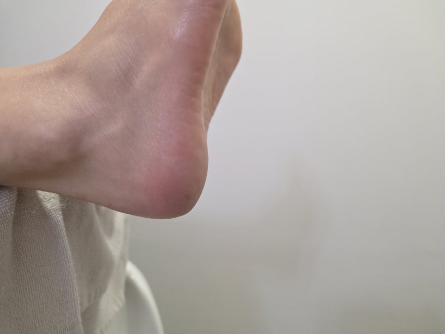 부평 발각질 제거, 아로마 풋스파로 여름 발 관리 — 사진 14