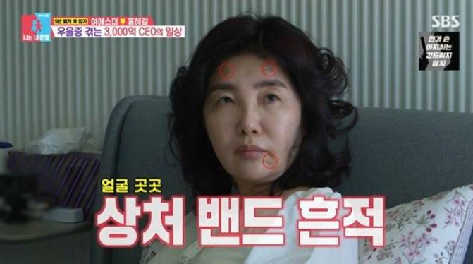 매달 1억 8천 지원 홍혜걸 여에스더 덕에 산다 장항준 도경완도 안 부럽다는 이유 지금 다시 보는 사람 이미지 4