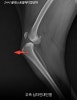 용인 24시 블레스동물병원, 강아지 십자인대파열 TPLO 수술 후기 — 사진 2