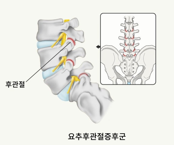 익산바른몸한의원 블로그 본문 이미지