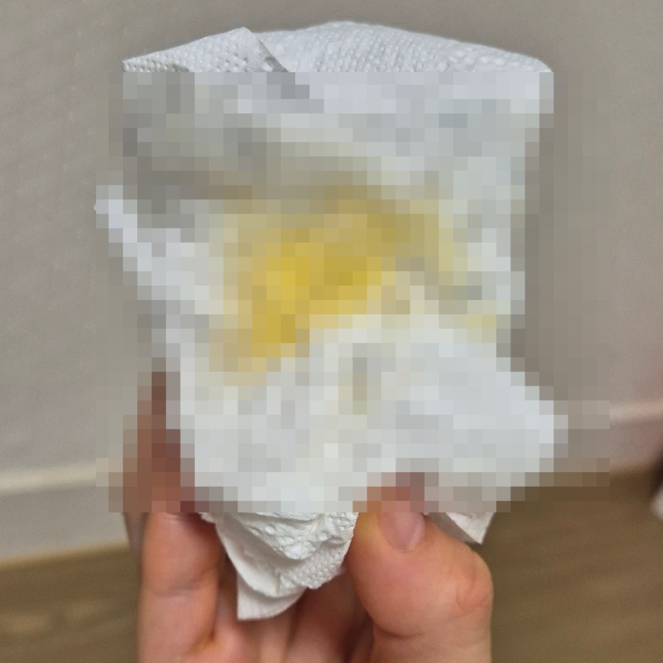 강아지 췌장염 원인과 간식 관리, 회복 후기 — 사진 5