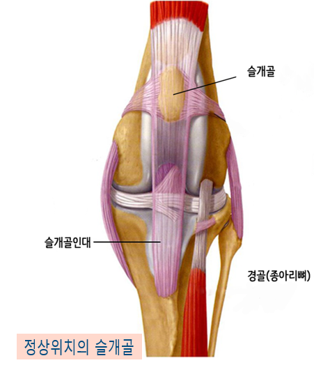 1살 강아지 양측 슬개골 탈구 수술 후기 — 사진 2
