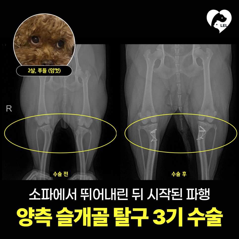 강아지 슬개골 탈구 3기 수술, 김해 24시 동물병원 사례