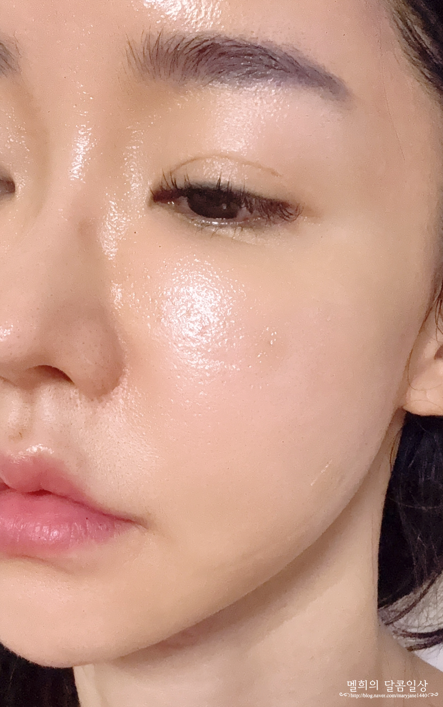 신상 스킨부스터 셀투오 내돈내산 후기! 리투오 + PRP 줄기세포 효과 요즘 다시 관심이 커진 이유 이미지 6