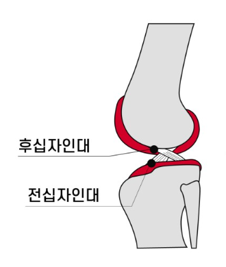 2살 강아지 십자인대 수술 후기: TPLO 성공 사례 — 사진 2