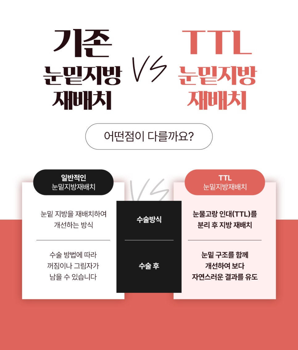 강남 눈밑지, 제대로 된 병원 선택하는 기준은 관련 이미지 4