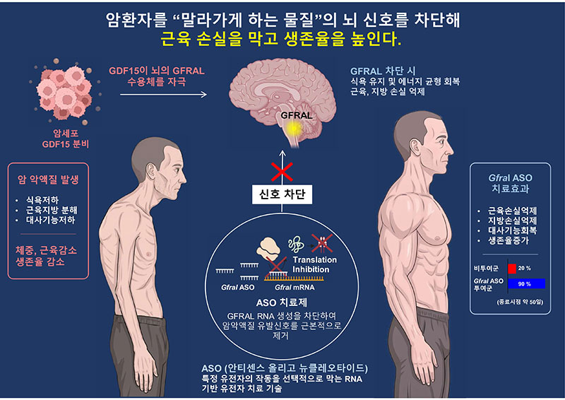 먹어도 계속 살 빠져요 암 환자 괴롭히는 암 악액질 막는다 예전과 완전히 달라졌다 이미지 1