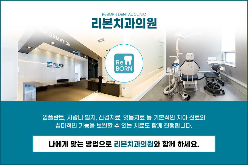 통진읍치과 임플란트 잘하는곳 고르실 때 보시는 기준