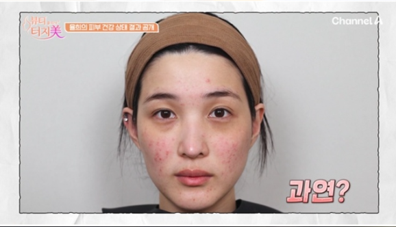 최민환과 이혼 후 최악의 피부가 되어버린 안타까운 율희 사연 다시 엮이면서 화제가 됐다 이미지 2