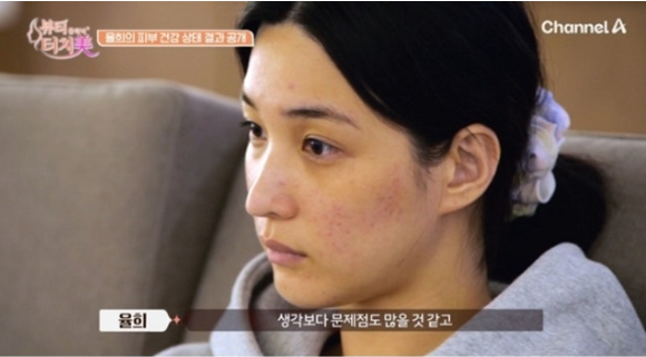 최민환과 이혼 후 최악의 피부가 되어버린 안타까운 율희 사연 다시 엮이면서 화제가 됐다 이미지 4