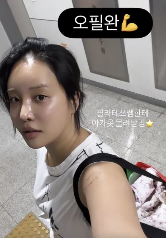 위고비도 마운자로도 아니었다 랄랄이 6개월 만에 10kg 뺀 진짜 비법은 최근 분위기가 확 바뀌었다 이미지 1