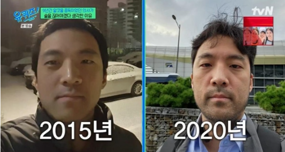 간 전문의사가 알코올중독이었다니 최근 분위기가 확 바뀌었다 이미지 5