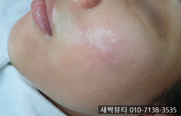 새싹뷰티 후기 사진