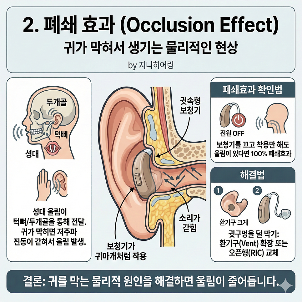 보청기를 착용하면 내 목소리가 울리는 이유!(완벽정리) — 원문 이미지 5