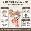 보청기를 착용하면 내 목소리가 울리는 이유!(완벽정리) — 원문 이미지 7