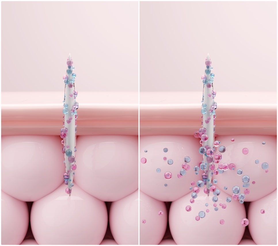 To a Clear Skin Clinic That Uses Only High-End Products in Gangnam Ellevie Rituo! image 4