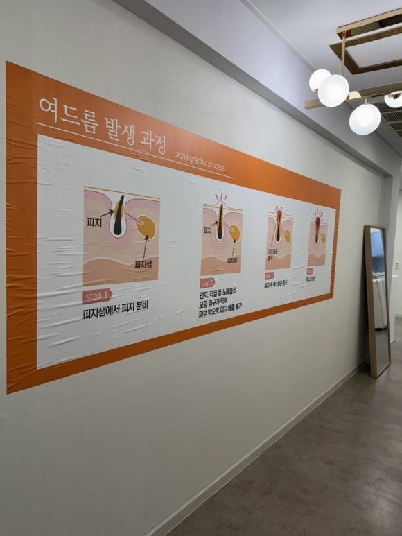🏷️휴무기록,양산 여드름살롱 압출 잘하는 곳, 붉은기 진정까지 완벽