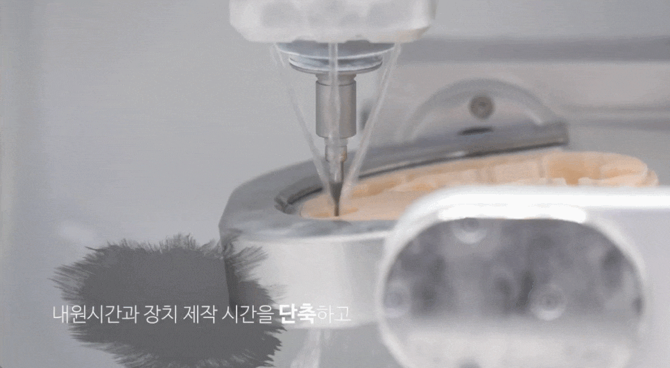 심미보철, 결과를 먼저 확인하고 결정합니다. [스마일리허설] 관련 이미지 7