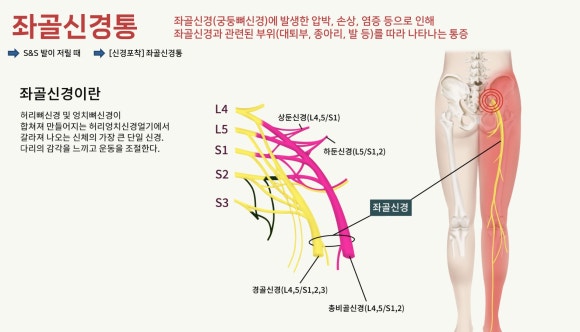 익산바른몸한의원 블로그 본문 이미지