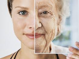 노화, 노화에 따른 근감소증(Sarcopenia)
