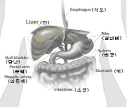 Hepatocellular carcinoma : HCC : 네이버 블로그