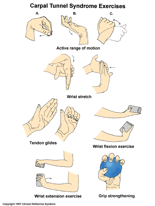 수근관 증후군(Carpal Tunnel Syndrome) 네이버 블로그