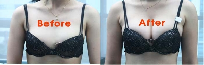 튜닝업 이미지